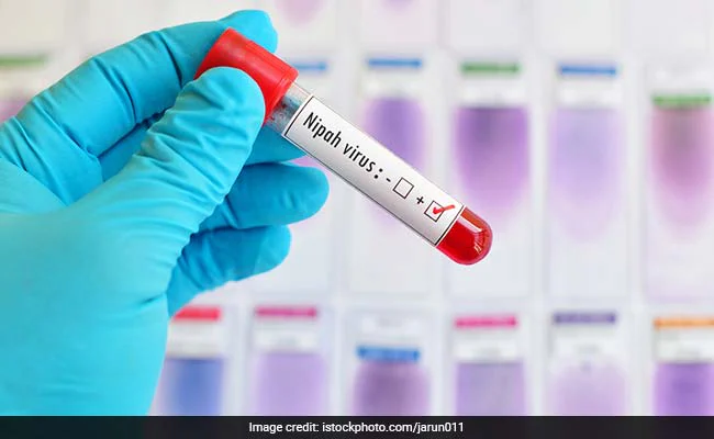 केरल में निपाह वायरस से 2 लोगों की मौत, स्वास्थ्य मंत्री ने मदद के लिए भेजी टीम